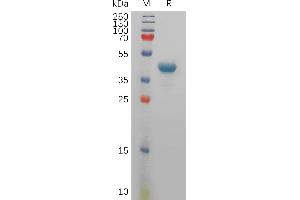 Human TS Protein, hFc Tag on SDS-PAGE under reducing condition.