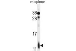 Western Blotting (WB) image for anti-Ribosomal Protein L39 (RPL39) antibody (ABIN2996042)