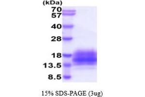 SDS-PAGE (SDS) image for Tetraspanin 7 (TSPAN7) (AA 113-213) protein (His tag) (ABIN5778008)