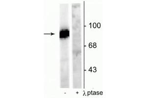 Western blot of rat hippocampal lysate stimulated with forskolin showing specific immunolabeling of the ~95 kDa dynamin phosphorylated at Ser778 in the first lane (-). (Dynamin 1 antibody  (pSer778))