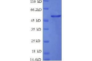 Enolase 1, (Alpha) (ENO1) (AA 2-433), (partial) protein (His tag) (ENO1 Protein (AA 2-433, partial) (His tag))