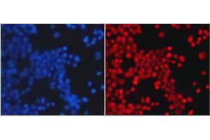 Immunofluorescence analysis of 293T cells using TriMethyl-Histone H4-K20 Polyclonal Antibody (Histone H4 antibody  (3meLys20))