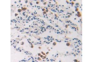 Immunohistochemistry (IHC) image for anti-Enhancer of Zeste Homolog 1 (EZH1) (AA 559-747) antibody (ABIN1867810)