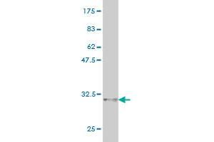 Corneodesmosin antibody  (AA 306-355)