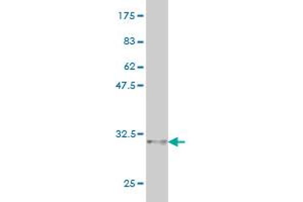 Corneodesmosin antibody  (AA 306-355)