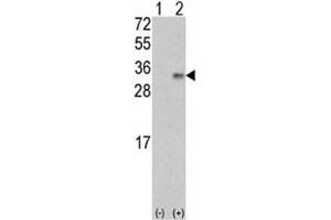 Western blot analysis of VEGFB antibody and 293 cell lysate (2 ug/lane) either nontransfected (Lane 1) or transiently transfected with the VEGF2/VEGFB gene (2). (VEGFB (VEGF2) (AA 110-139) antibody)