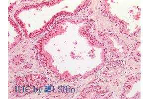 ABIN334503 (5µg/ml) staining of paraffin embedded Human Prostate. (TARDBP antibody  (Internal Region))