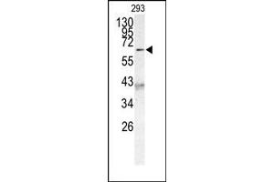 Image no. 1 for anti-Protein AF-9 (MLLT3) (C-Term) antibody (ABIN358673) (AF9 antibody  (C-Term))