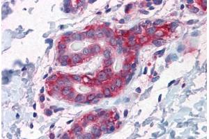 Human Breast: Formalin-Fixed, Paraffin-Embedded (FFPE) (G3BP1 antibody  (AA 214-303))