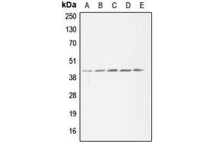 Western blot analysis of ACAT1 expression in HeLa (A), HEK293T (B), SP2/0 (C), H9C2 (D), THP1 (E) whole cell lysates. (ACAT1 antibody  (Center))