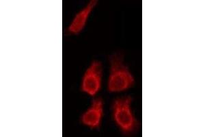 ABIN6275767 staining HeLa by IF/ICC. (HSPBAP1 antibody  (Internal Region))