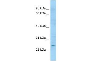 WB Suggested Anti-APOBEC3H Antibody Titration: 1.