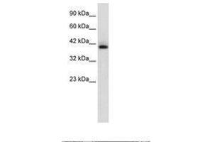 Image no. 1 for anti-Hexamethylene Bis-Acetamide Inducible 1 (HEXIM1) (C-Term) antibody (ABIN202339)