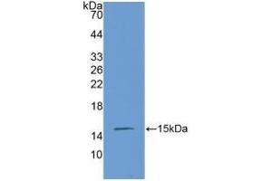 Detection of Recombinant CTGF, Mouse using Polyclonal Antibody to Connective Tissue Growth Factor (CTGF) (CTGF antibody  (AA 245-346))