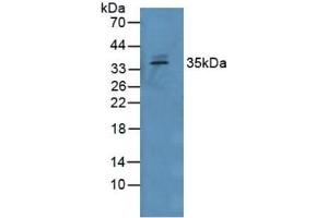 Detection of GDF15 in Human Serum using Polyclonal Antibody to Growth Differentiation Factor 15 (GDF15) (GDF15 antibody  (AA 195-308))