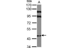 WB Image Sample (30 ug of whole cell lysate) A: MCF-7 7. (ZNF384 antibody  (N-Term))