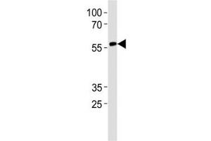 RUNX2 antibody western blot analysis in CEM lysate. (RUNX2 antibody  (AA 445-474))