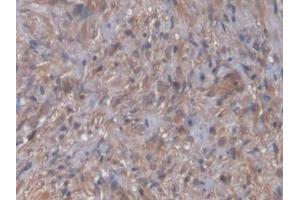 NT-ProBNP antibody  (AA 27-102)