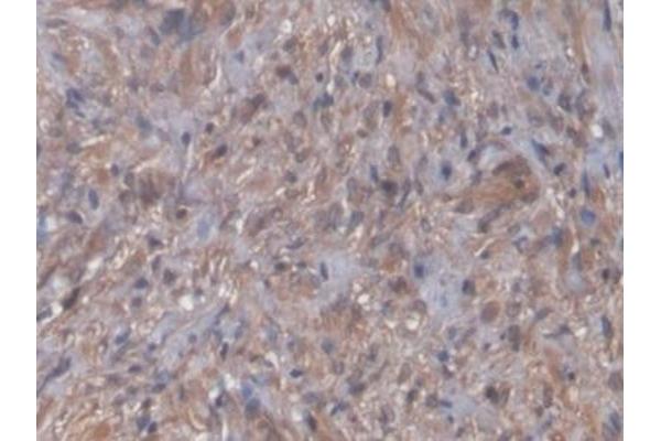 NT-ProBNP antibody  (AA 27-102)