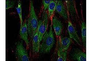 Immunofluorescence (IF) image for anti-Son of Sevenless Homolog 1 (SOS1) antibody (ABIN238504) (SOS1 antibody)