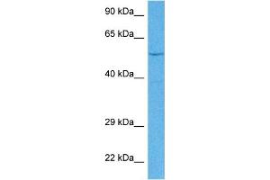 Host:  Rabbit  Target Name:  EYA1  Sample Tissue:  Human MCF7 Whole Cell  Antibody Dilution:  1ug/ml (EYA1 antibody  (Middle Region))