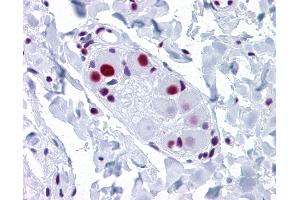 Anti-SNRPA antibody IHC of human small intestine, submucosal plexus. (SNRPA1 antibody  (AA 1-283))