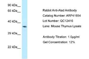 Host: Rabbit Target Name: ALAD Sample Tissue: Mouse Thymus Antibody Dilution: 1ug/ml (ALAD antibody  (N-Term))
