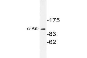 Western blot with extracts from A549 cells using c-Kit antibody . (KIT antibody)