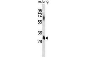 Western blot analysis in mouse lung tissue lysates (35ug/lane) using ELOVL7  Antibody (C-term). (ELOVL7 antibody  (C-Term))