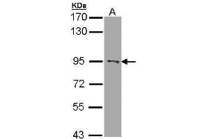 WB Image Sample (30 ug of whole cell lysate) A: A431 , 7. (RASAL1 antibody  (C-Term))