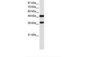 Image no. 1 for anti-POU Class 3 Homeobox 2 (POU3F2) (C-Term) antibody (ABIN6736167) (POU3F2 antibody  (C-Term))