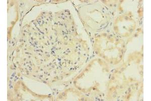 Immunohistochemistry of paraffin-embedded human kidney tissue using ABIN7173386 at dilution of 1:100 (TMEM38B antibody  (AA 249-291))