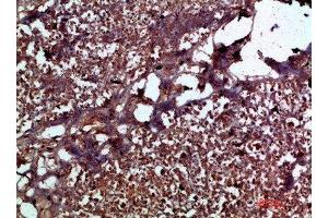Immunohistochemical analysis of paraffin-embedded human-pancreas, antibody was diluted at 1:200 (IL17C antibody  (AA 81-130))