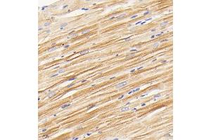 Immunohistochemistry analysis of paraffin embedded rat heart using PDK3 (ABIN7075334) at dilution of 1: 2000 (PDK3 antibody)