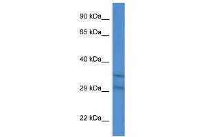 WB Suggested Anti-Slc25a31 Antibody Titration: 1. (SLC25A31 antibody  (Middle Region))