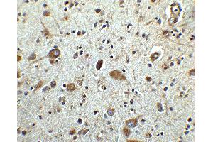 Immunohistochemical analysis of paraffin-embedded human brain tissue using anti-MANF antibody (ABIN6990751) at 2.