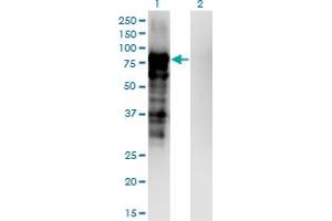 Western Blot analysis of PKP3 expression in transfected 293T cell line by PKP3 monoclonal antibody (M04), clone 6E5. (Plakophilin 3 antibody  (AA 225-324))