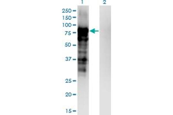 Plakophilin 3 anticorps  (AA 225-324)