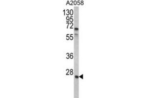 Western Blotting (WB) image for anti-Growth Factor Receptor-Bound Protein 2 (GRB2) antibody (ABIN3002593)