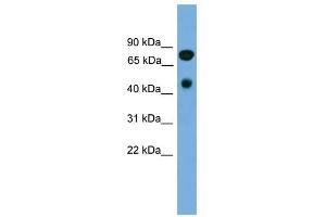 RIPK4 antibody used at 1 ug/ml to detect target protein. (RIPK4 antibody  (N-Term))