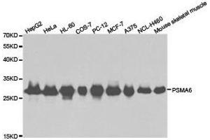 Western Blotting (WB) image for anti-Proteasome Subunit alpha 6 (PSMA6) antibody (ABIN1874369) (PSMA6 antibody)