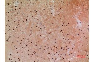 Immunohistochemistry (IHC) image for anti-Calcyclin Binding Protein (CACYBP) (C-Term) antibody (ABIN3187896)