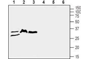 Western blot analysis of mouse lung (lanes 1 and 4), rat brain (lanes 2 and 5) and mouse brain (lanes 3 and 6) lysates: - 1-3. (SLC39A3 antibody  (1st Extracellular Loop))