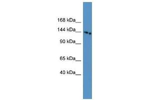 Western Blot showing SLC4A5 antibody used at a concentration of 1-2 ug/ml to detect its target protein. (NBC4 antibody  (N-Term))