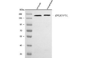Western blot analysis of RPGRIP1L using anti-RPGRIP1L antibody (ABIN7602162).