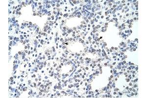 MCM6 antibody was used for immunohistochemistry at a concentration of 4-8 ug/ml to stain Alveolar cells (arrows) in Human Lung. (MCM6 antibody  (C-Term))
