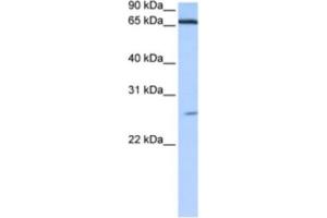 Western Blotting (WB) image for anti-Zinc Finger Protein 879 (ZNF879) antibody (ABIN2463464) (ZNF879 antibody)
