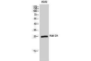 Western Blotting (WB) image for anti-RAB2A, Member RAS Oncogene Family (RAB2A) (Internal Region) antibody (ABIN3177066) (RAB2A antibody  (Internal Region))