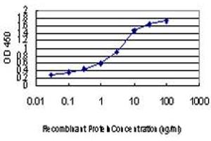 Detection limit for recombinant GST tagged DOT1L is approximately 0. (DOT1L antibody  (AA 3-108))