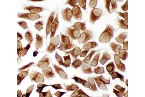 ICC testing of TRAM antibody and HeLa cells (TICAM2 antibody  (C-Term))